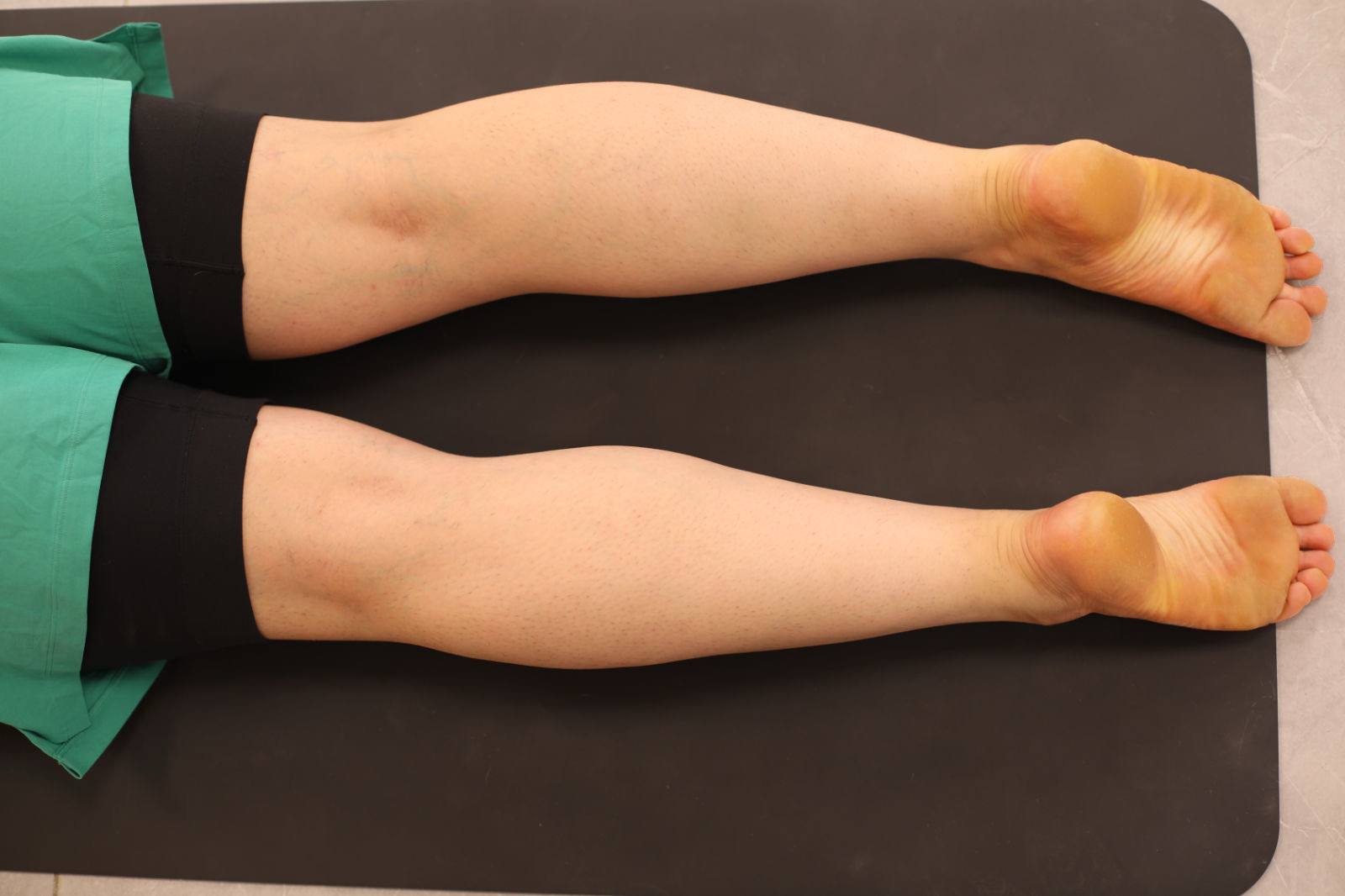 قرارگیری صحیح پاها در وضعیت کبرا (Bhujangasana) – رویه پاها کاملاً روی زمین و کشیده