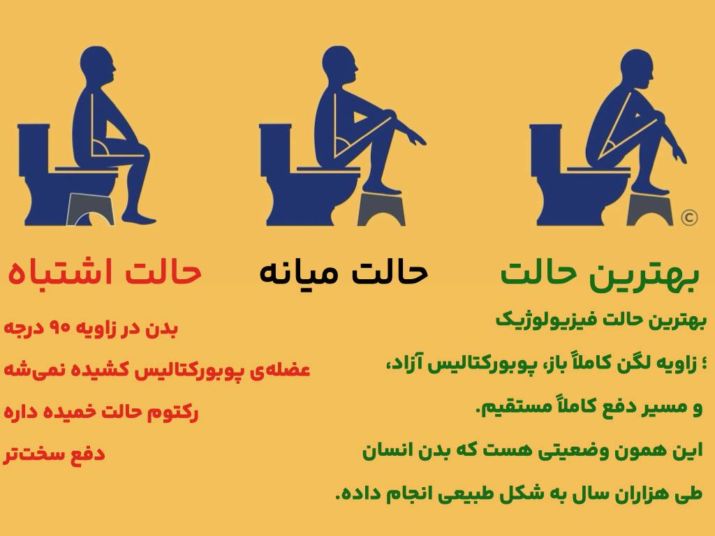 تصویر مقایسه حالت اشتباه، حالت میانه و بهترین حالت نشستن در توالت برای بهبود دفع و سلامت گوارش