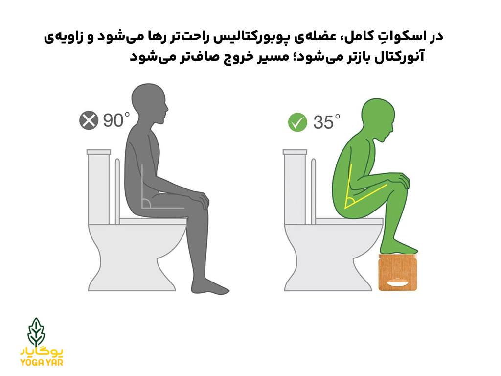 مقایسه وضعیت نشستن در توالت فرنگی و توالت ایرانی برای بهبود عملکرد گوارش